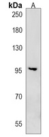Anti-CCDC141 Antibody