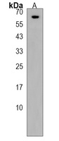 Anti-KLHL25 Antibody