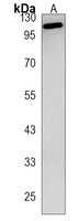 Anti-PKD2L1 Antibody