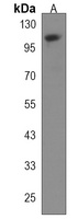 Anti-KIF18A Antibody