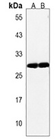 Anti-OR4F17 Antibody