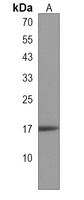 Anti-CHCHD10 Antibody