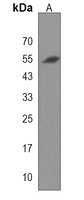 Anti-RBM45 Antibody