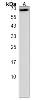 Anti-CLPTM1L Antibody