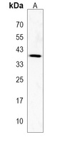 Anti-MAGEB10 Antibody