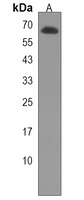 Anti-ARHGAP36 Antibody