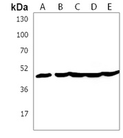 Anti-KRT28 Antibody