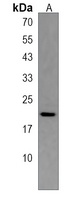 Anti-TTC33 Antibody