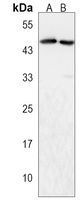 Anti-ZDHHC6 Antibody