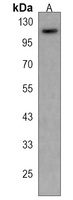 Anti-PCSK6 Antibody