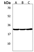 Anti-TGIF2 Antibody