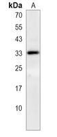 Anti-NTAL Antibody