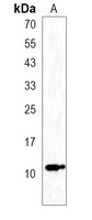 Anti-ACBD7 Antibody