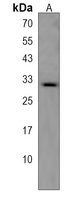 Anti-TRA2B Antibody