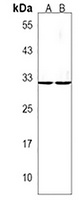 Anti-YBX3 Antibody