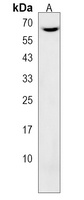 Anti-CNOT4 Antibody