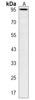 Anti-PKN3 Antibody