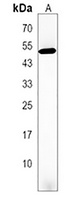 Anti-HOXD3 Antibody