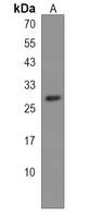 Anti-CTDSP2 Antibody