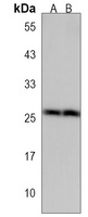 Anti-FRAT1 Antibody