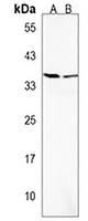 Anti-OR52H1 Antibody