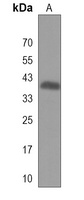 Anti-POMK Antibody