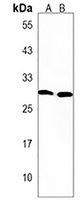 Anti-HOXC9 Antibody