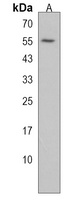 Anti-MKK7 Antibody