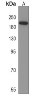 Anti-CD163b Antibody