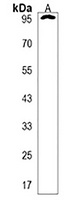 Anti-ANKS6 Antibody