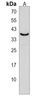 Anti-PNPLA4 Antibody