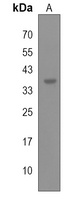 Anti-DPAGT1 Antibody