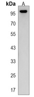 Anti-MYLK3 Antibody