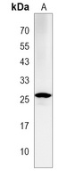 Anti-LAPTM4A Antibody