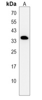 Anti-DHRS7C Antibody