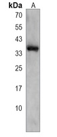 Anti-CELA3B Antibody