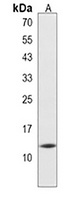 Anti-HIST2H2AB Antibody