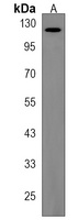 Anti-TTC13 Antibody