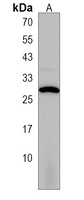 Anti-VKORC1L1 Antibody