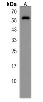 Anti-ASPG Antibody