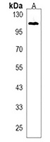 Anti-RHBDF2 Antibody