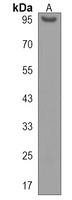 Anti-SIDT1 Antibody