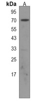 Anti-ZNF415 Antibody