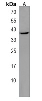 Anti-PTPLA Antibody