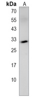 Anti-CCDC117 Antibody