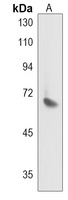 Anti-JPH2 Antibody