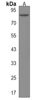 Anti-USP45 Antibody