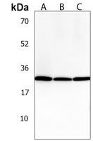 Anti-PGAM4 Antibody