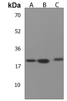 Anti-ARL6IP6 Antibody