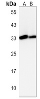Anti-PI15 Antibody